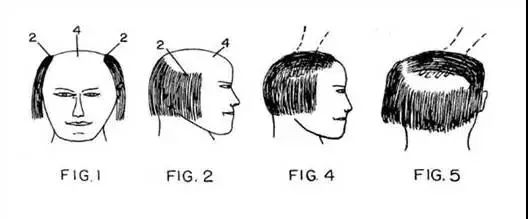 五款防止脫發(fā)的“正經(jīng)”專利！