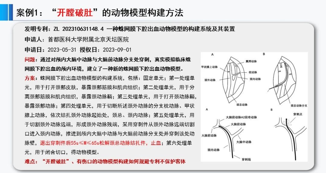 正在投稿SCI的醫(yī)學(xué)專家必看：哪些SCI文章會(huì)錯(cuò)失發(fā)明專利成果